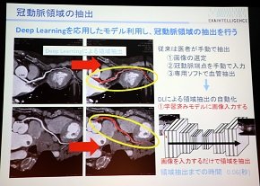 ディープラーニングによる領域抽出